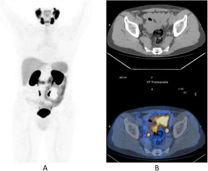 https://cdn.ncbi.nlm.nih.gov/pmc/blobs/2033/8218094/0e1e04f3d127/41824_2019_66_Fig31_HTML.jpg