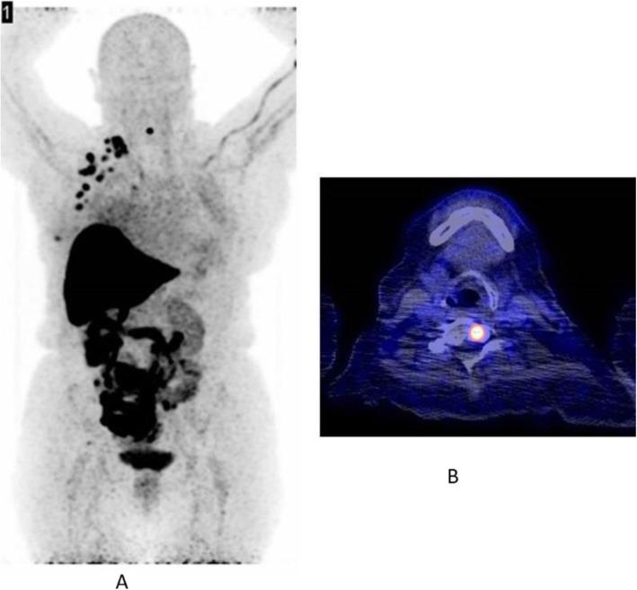 https://cdn.ncbi.nlm.nih.gov/pmc/blobs/2033/8218094/0ebe66268650/41824_2019_66_Fig5_HTML.jpg