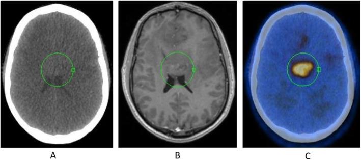 https://cdn.ncbi.nlm.nih.gov/pmc/blobs/2033/8218094/1b15b2c02a4a/41824_2019_66_Fig8_HTML.jpg
