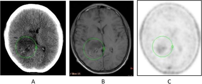 https://cdn.ncbi.nlm.nih.gov/pmc/blobs/2033/8218094/28e4131de403/41824_2019_66_Fig9_HTML.jpg
