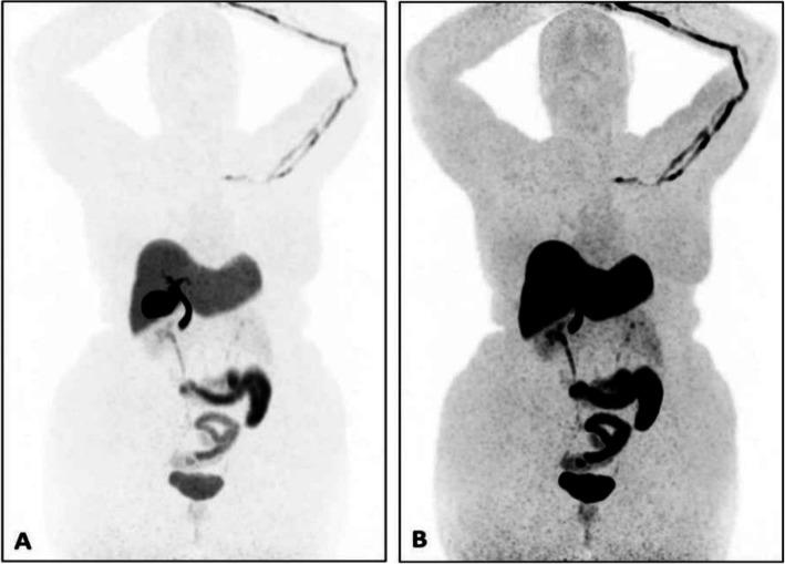 https://cdn.ncbi.nlm.nih.gov/pmc/blobs/2033/8218094/30353c891cbc/41824_2019_66_Fig4_HTML.jpg