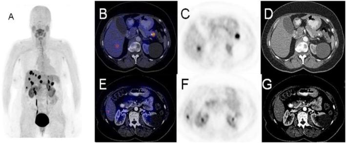 https://cdn.ncbi.nlm.nih.gov/pmc/blobs/2033/8218094/32e4b555a6c0/41824_2019_66_Fig45_HTML.jpg