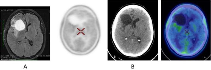 https://cdn.ncbi.nlm.nih.gov/pmc/blobs/2033/8218094/3d7408af9bb7/41824_2019_66_Fig16_HTML.jpg