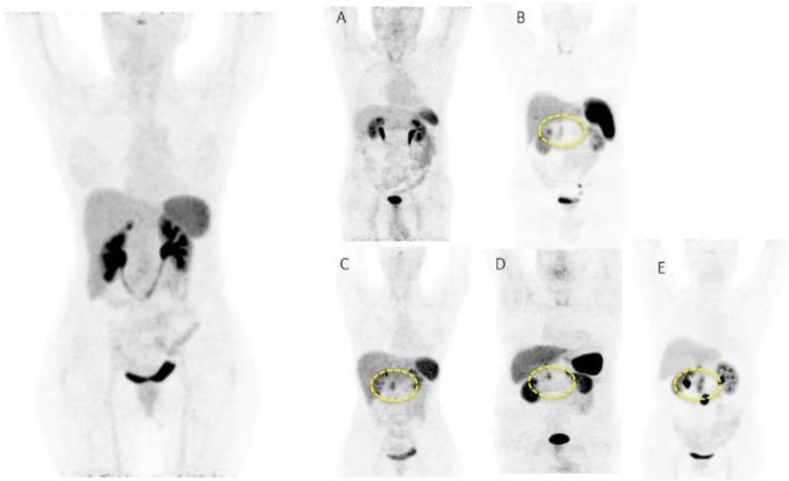 https://cdn.ncbi.nlm.nih.gov/pmc/blobs/2033/8218094/414495eb281f/41824_2019_66_Fig46_HTML.jpg