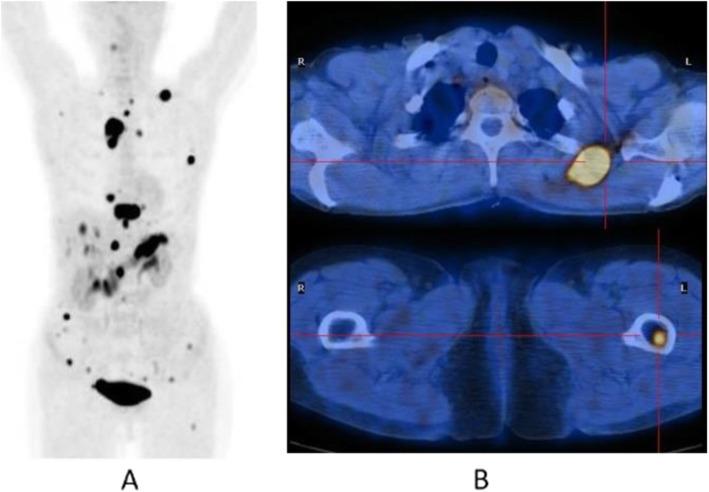 https://cdn.ncbi.nlm.nih.gov/pmc/blobs/2033/8218094/4898523ad9f7/41824_2019_66_Fig43_HTML.jpg