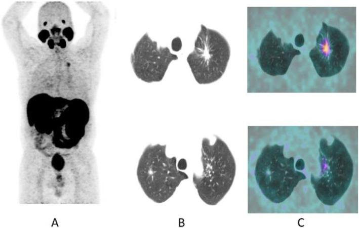 https://cdn.ncbi.nlm.nih.gov/pmc/blobs/2033/8218094/567bf50334e9/41824_2019_66_Fig37_HTML.jpg