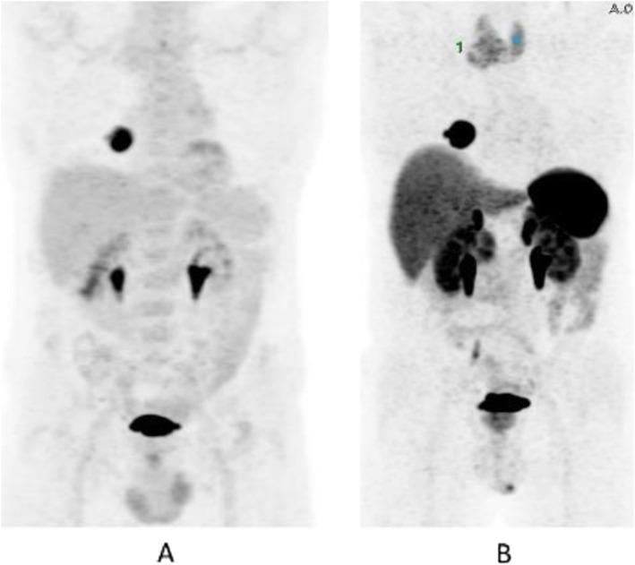 https://cdn.ncbi.nlm.nih.gov/pmc/blobs/2033/8218094/637fe199881f/41824_2019_66_Fig52_HTML.jpg