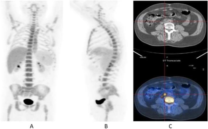 https://cdn.ncbi.nlm.nih.gov/pmc/blobs/2033/8218094/65d5d6fdb957/41824_2019_66_Fig14_HTML.jpg
