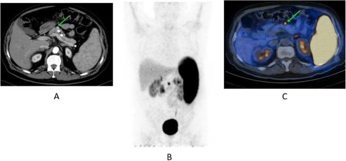 https://cdn.ncbi.nlm.nih.gov/pmc/blobs/2033/8218094/674c7ed5bbb3/41824_2019_66_Fig48_HTML.jpg