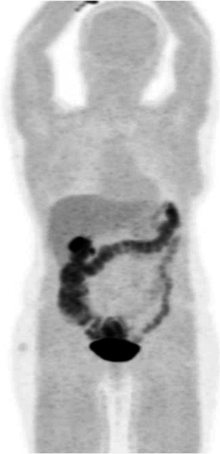https://cdn.ncbi.nlm.nih.gov/pmc/blobs/2033/8218094/6ece8f2915c7/41824_2019_66_Fig66_HTML.jpg