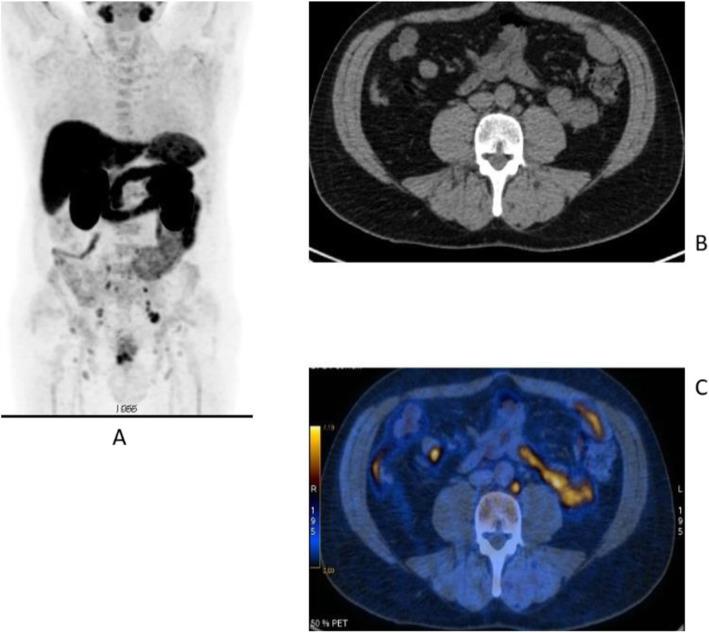 https://cdn.ncbi.nlm.nih.gov/pmc/blobs/2033/8218094/714320423ce0/41824_2019_66_Fig20_HTML.jpg