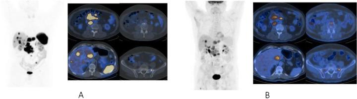 https://cdn.ncbi.nlm.nih.gov/pmc/blobs/2033/8218094/7440b15b9828/41824_2019_66_Fig53_HTML.jpg