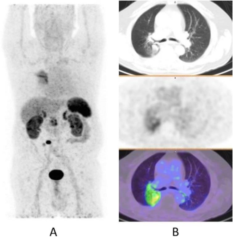 https://cdn.ncbi.nlm.nih.gov/pmc/blobs/2033/8218094/745fa60f17f4/41824_2019_66_Fig58_HTML.jpg