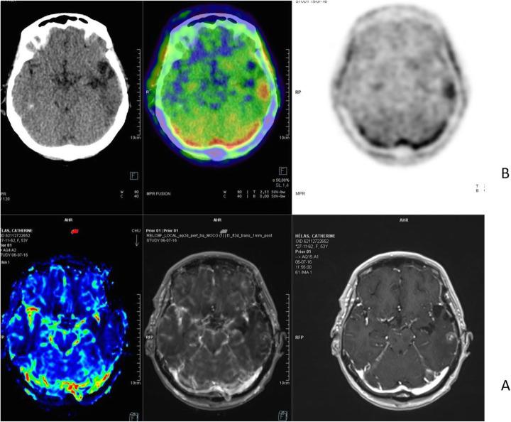 https://cdn.ncbi.nlm.nih.gov/pmc/blobs/2033/8218094/79b63afa3147/41824_2019_66_Fig10_HTML.jpg