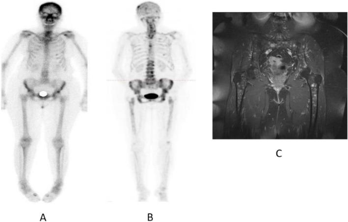 https://cdn.ncbi.nlm.nih.gov/pmc/blobs/2033/8218094/8cab689896d8/41824_2019_66_Fig71_HTML.jpg