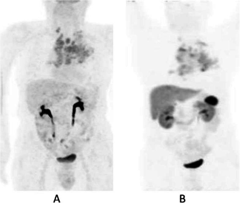 https://cdn.ncbi.nlm.nih.gov/pmc/blobs/2033/8218094/933e439792fa/41824_2019_66_Fig60_HTML.jpg