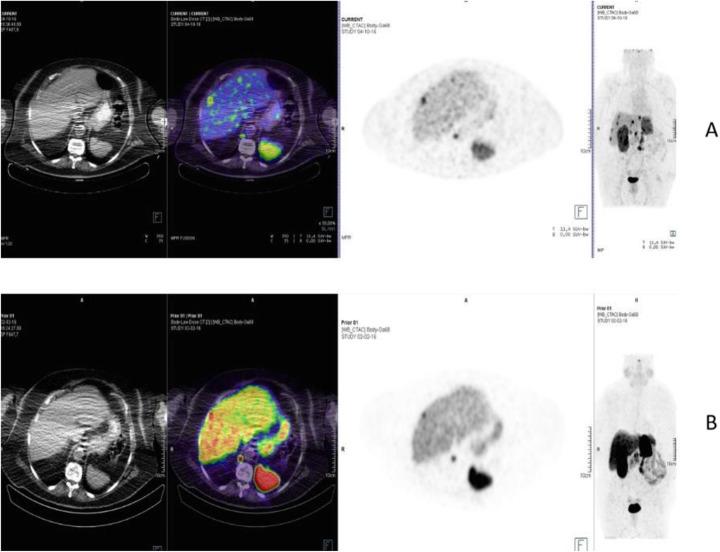 https://cdn.ncbi.nlm.nih.gov/pmc/blobs/2033/8218094/936768484c0a/41824_2019_66_Fig47_HTML.jpg