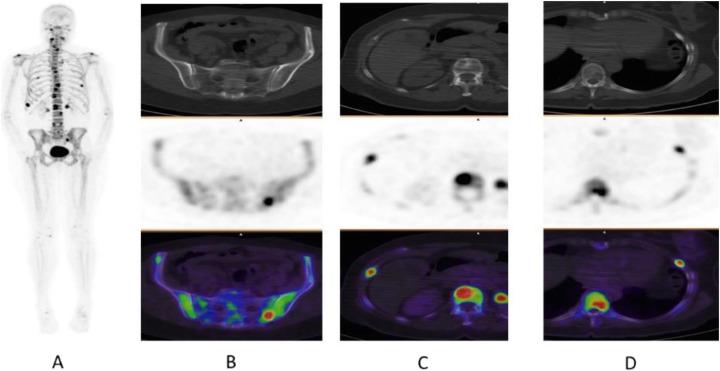 https://cdn.ncbi.nlm.nih.gov/pmc/blobs/2033/8218094/9b9656c85620/41824_2019_66_Fig70_HTML.jpg