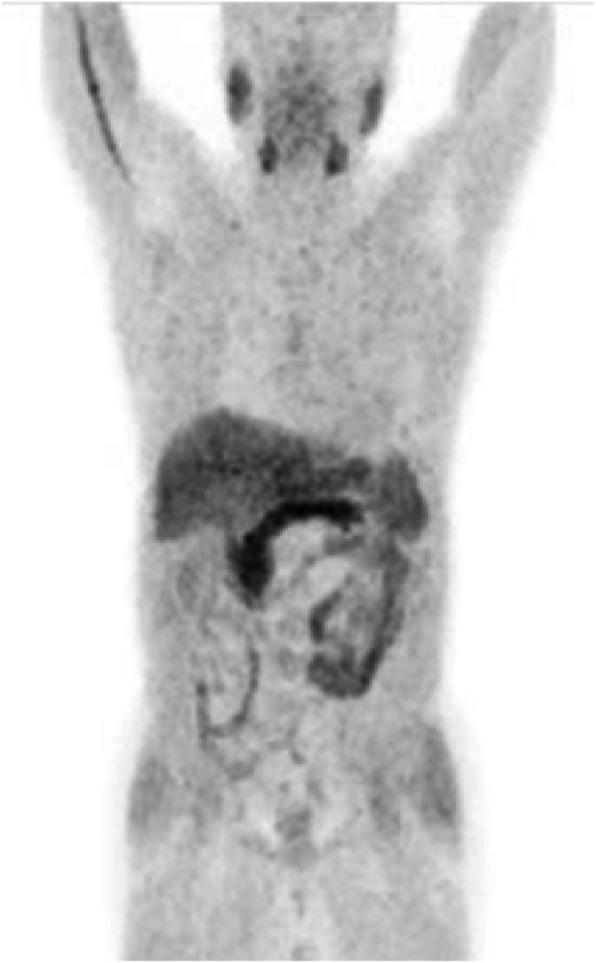 https://cdn.ncbi.nlm.nih.gov/pmc/blobs/2033/8218094/a4d764111cca/41824_2019_66_Fig1_HTML.jpg