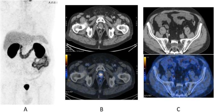 https://cdn.ncbi.nlm.nih.gov/pmc/blobs/2033/8218094/a7c458fe05f1/41824_2019_66_Fig32_HTML.jpg
