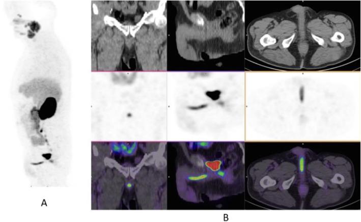 https://cdn.ncbi.nlm.nih.gov/pmc/blobs/2033/8218094/a7e5dce51a50/41824_2019_66_Fig30_HTML.jpg