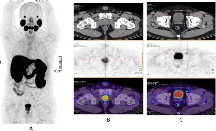 https://cdn.ncbi.nlm.nih.gov/pmc/blobs/2033/8218094/b88cfe55841e/41824_2019_66_Fig27_HTML.jpg