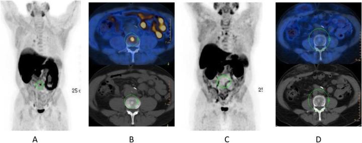 https://cdn.ncbi.nlm.nih.gov/pmc/blobs/2033/8218094/bf8083ece9b9/41824_2019_66_Fig24_HTML.jpg