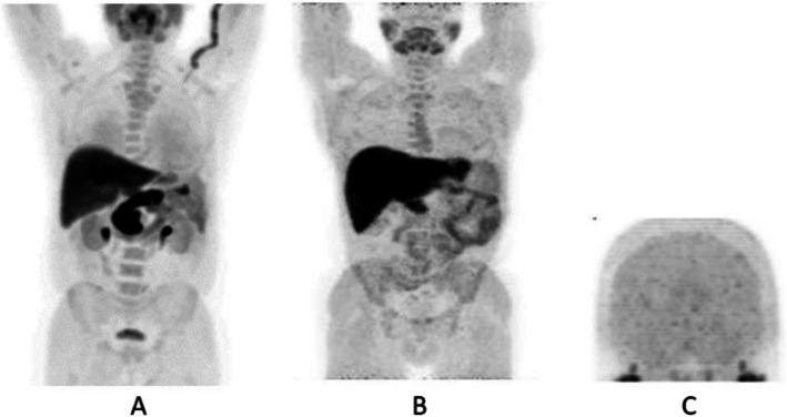 https://cdn.ncbi.nlm.nih.gov/pmc/blobs/2033/8218094/c56abd20a0cf/41824_2019_66_Fig15_HTML.jpg