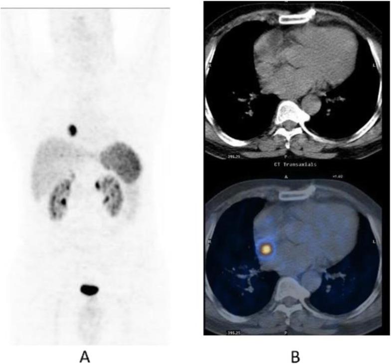 https://cdn.ncbi.nlm.nih.gov/pmc/blobs/2033/8218094/c808a197dc2d/41824_2019_66_Fig61_HTML.jpg