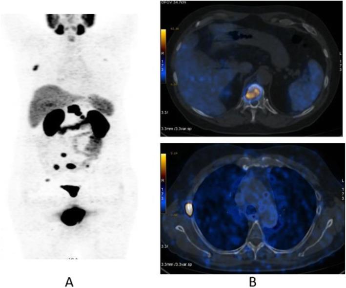 https://cdn.ncbi.nlm.nih.gov/pmc/blobs/2033/8218094/d0c7878eb5d6/41824_2019_66_Fig34_HTML.jpg