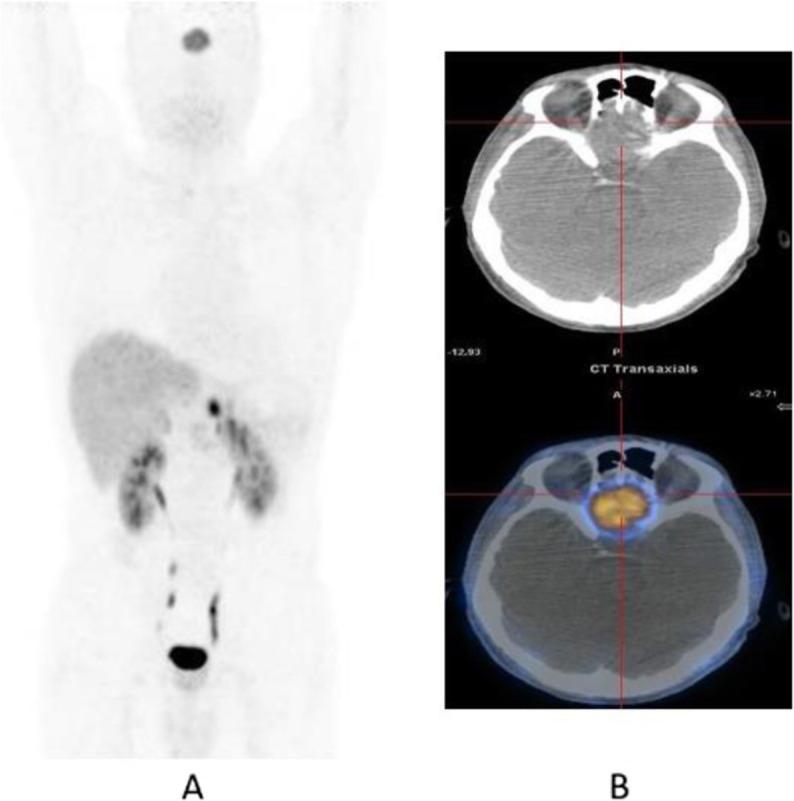 https://cdn.ncbi.nlm.nih.gov/pmc/blobs/2033/8218094/d576db5a99ce/41824_2019_66_Fig65_HTML.jpg
