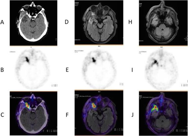 https://cdn.ncbi.nlm.nih.gov/pmc/blobs/2033/8218094/d89361149e5b/41824_2019_66_Fig64_HTML.jpg