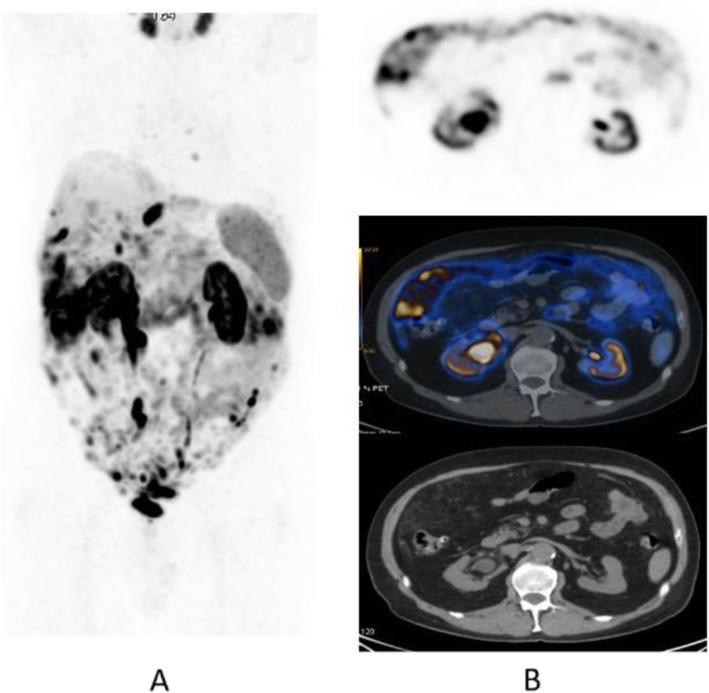 https://cdn.ncbi.nlm.nih.gov/pmc/blobs/2033/8218094/db5011804afe/41824_2019_66_Fig35_HTML.jpg