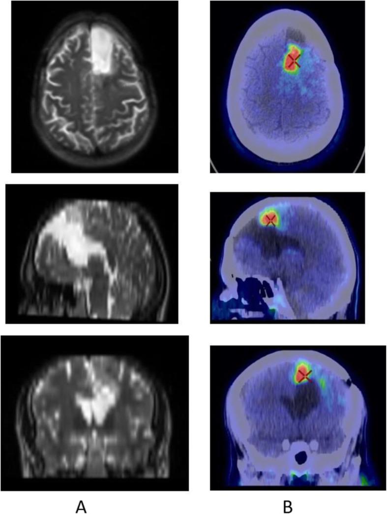 https://cdn.ncbi.nlm.nih.gov/pmc/blobs/2033/8218094/dc351cdb0af6/41824_2019_66_Fig17_HTML.jpg