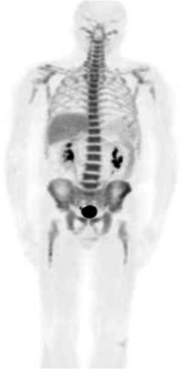 https://cdn.ncbi.nlm.nih.gov/pmc/blobs/2033/8218094/dc772c10ceb4/41824_2019_66_Fig11_HTML.jpg