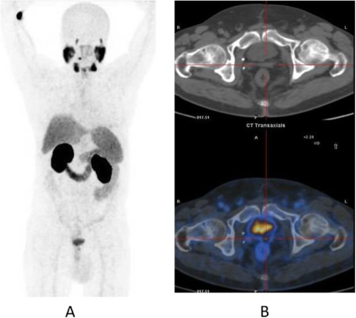 https://cdn.ncbi.nlm.nih.gov/pmc/blobs/2033/8218094/def47cc8d441/41824_2019_66_Fig29_HTML.jpg