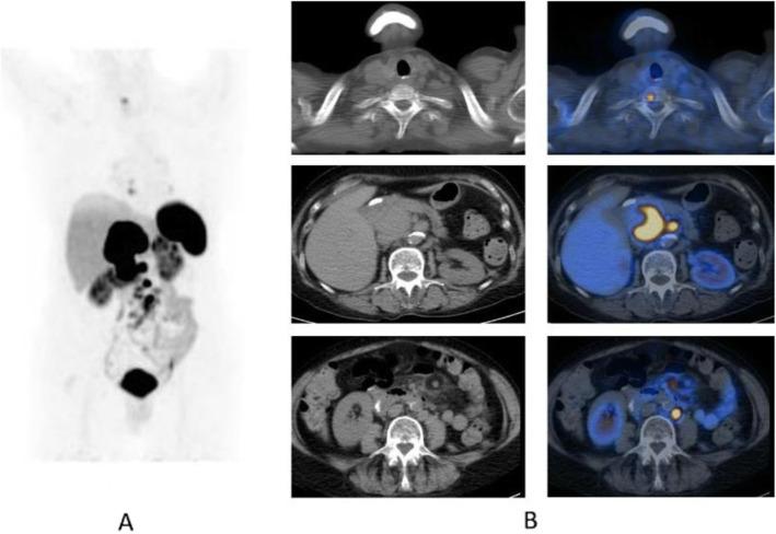 https://cdn.ncbi.nlm.nih.gov/pmc/blobs/2033/8218094/e50a0f4ca48c/41824_2019_66_Fig59_HTML.jpg
