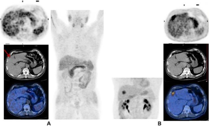 https://cdn.ncbi.nlm.nih.gov/pmc/blobs/2033/8218094/ec49a7408b24/41824_2019_66_Fig3_HTML.jpg