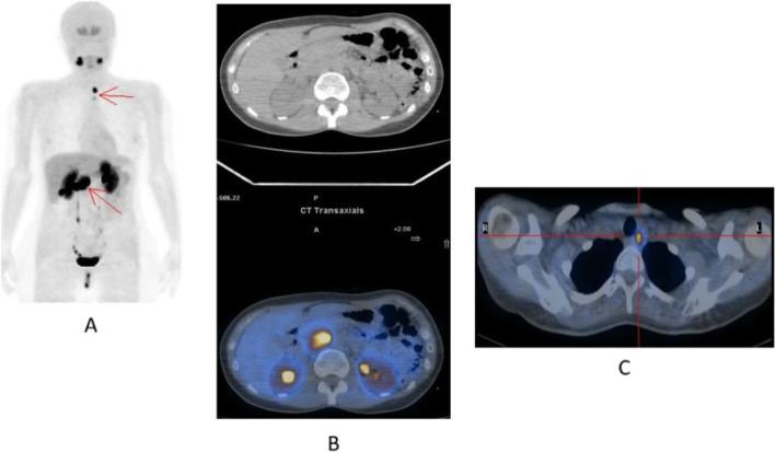 https://cdn.ncbi.nlm.nih.gov/pmc/blobs/2033/8218094/f69a7d3d3e37/41824_2019_66_Fig40_HTML.jpg