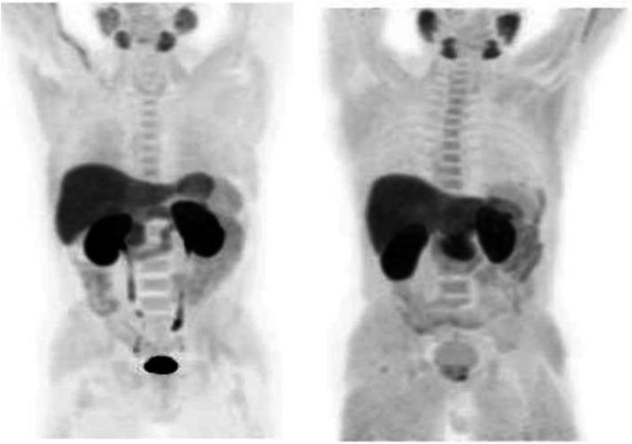 https://cdn.ncbi.nlm.nih.gov/pmc/blobs/2033/8218094/ffe226ea6260/41824_2019_66_Fig22_HTML.jpg