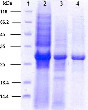https://cdn.ncbi.nlm.nih.gov/pmc/blobs/2035/2832885/247d60c7829f/792_2009_297_Fig5_HTML.jpg