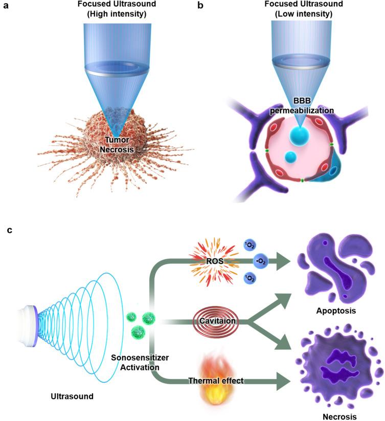 https://cdn.ncbi.nlm.nih.gov/pmc/blobs/2039/11566213/41daa9c2d9d1/IJN-19-11767-g0002.jpg