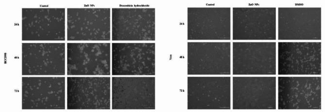 https://cdn.ncbi.nlm.nih.gov/pmc/blobs/2043/11618351/28af818b7335/41598_2024_81384_Fig11_HTML.jpg