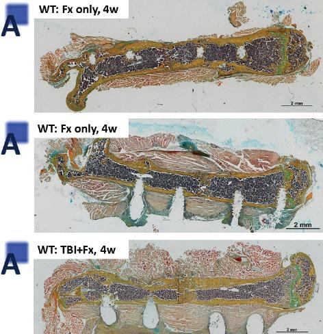 https://cdn.ncbi.nlm.nih.gov/pmc/blobs/2043/5881126/4175707f570d/JMNI-18-032-g006.jpg