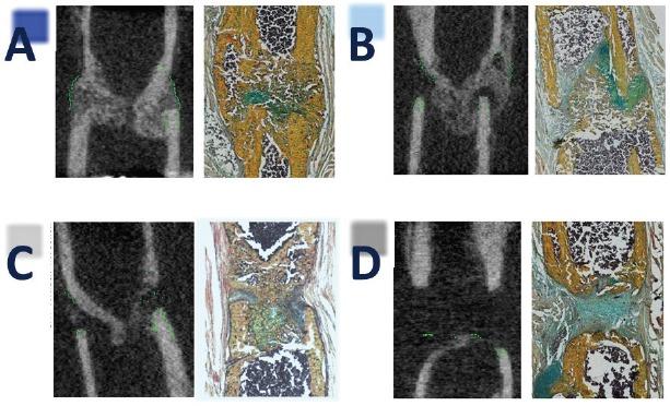 https://cdn.ncbi.nlm.nih.gov/pmc/blobs/2043/5881126/a9a91d05bd23/JMNI-18-032-g003.jpg