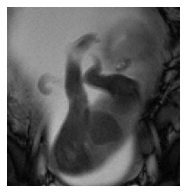 https://cdn.ncbi.nlm.nih.gov/pmc/blobs/2046/6535877/51c9ea1d900f/CRIOG2019-4530491.002.jpg