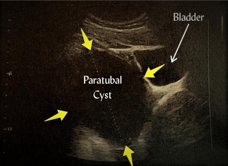 https://cdn.ncbi.nlm.nih.gov/pmc/blobs/2047/10121261/5dcadf7e6064/cureus-0015-00000036540-i01.jpg