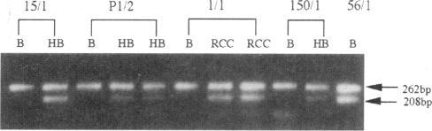 https://cdn.ncbi.nlm.nih.gov/pmc/blobs/2051/1712486/61b8b07d1d90/ajhg00004-0024-a.jpg