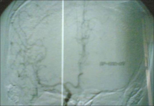 https://cdn.ncbi.nlm.nih.gov/pmc/blobs/2051/5409359/4e3fa6df1619/AJNS-12-159-g002.jpg