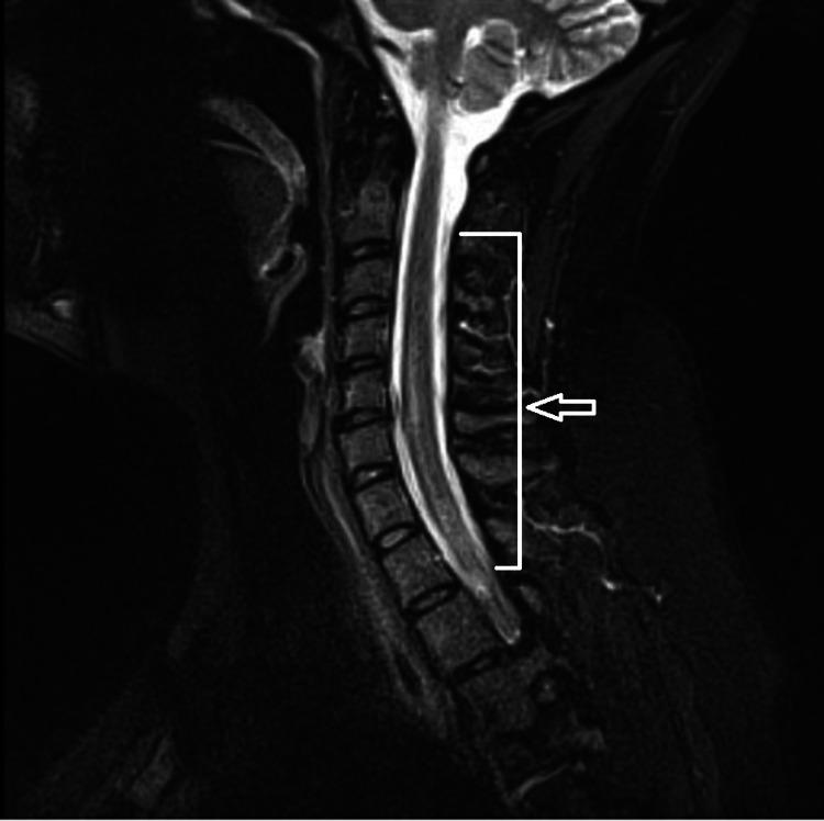 https://cdn.ncbi.nlm.nih.gov/pmc/blobs/2051/8384391/e7a693175f27/cureus-0013-00000016624-i01.jpg